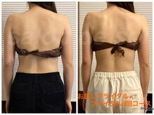 サロン ド ソワ(salon de soi)/脇のぷにょ肉スッキリ解消！