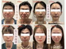 ビーキュート 姫路店(BE-CUTE)の雰囲気（それぞれのお悩みを改善し、美しい小顔に導きます☆）