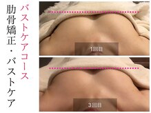 スナリ(SUNARI)/バストケア Before→After