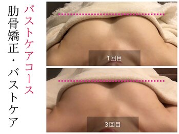 スナリ(SUNARI)/バストケア Before→After