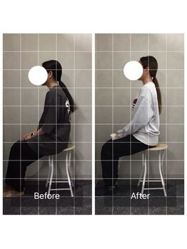 博多おかげ整体院/「猫背」からくる全身の不調