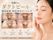 アウラ(AURA)