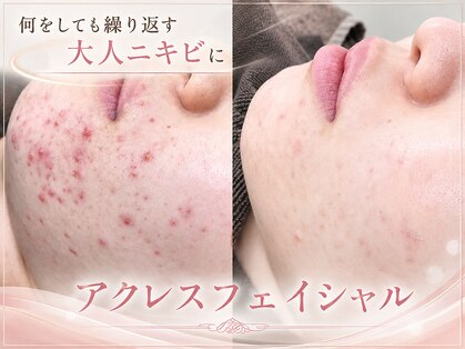 エピア 半田店(Epia)の写真