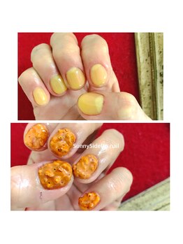 サニーサイドアップ ネイル(Sunny SideUp nail)/フライドチキンネイル
