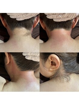 エンジェルワックス 新宿店(Angel Wax)/希望に合わせて脱毛できる