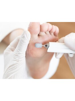 角質ケアができるサロン