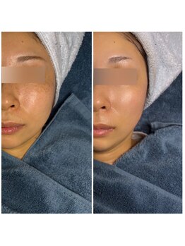 マシロ(MA SHIRO)/EMSマシン