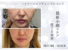 ユアーズ ビューティー(YOURS beauty)/