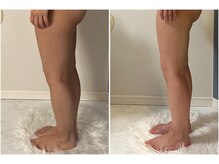 モア(moa)/痩身/下半身痩せ/むくみケア