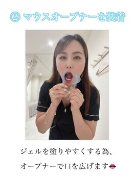 ホワイトニングショップ 柏店/(2)マウスオープナー装着