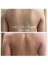 サロンアンドビューティ エス チャタン(Salon＆Beauty S chatan)/【Drリセラ】1ヶ月チャレンジ