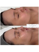 クレア(Clair)/イラストリアス症例