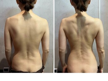 コスメ デ グレース(cosme de greace)/むくみ、こり、脂肪にアプローチ