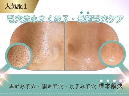 キザシ(kizashi)の写真