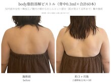 サボラミ(sabor A Mi)/背中のハミ肉に脂肪分解ピストル