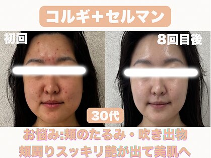 ナーナモエ(na-namoe)の写真