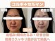 ナーナモエ(na-namoe)の写真