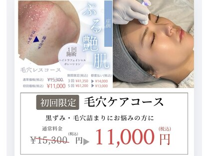 イム(im)の写真