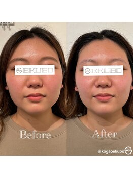 エクボ 立川店(EKUBO)/血行促進すっきりトーンアップ!!