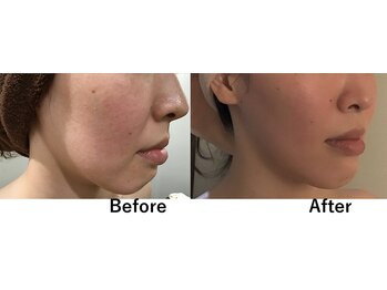 ビオモ 銀座(BIOMO)/マイナス１０歳若見え！