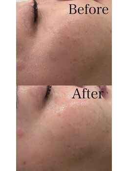 グランド ビューティー ビーズ 半田店(Grand Beauty B's)/シェービング