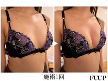 フーアップ 北千住(FU-UP)/バストアップ/育乳（1回）