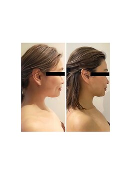 ルナグランデ 心斎橋店(Luna grande.)/横顔美人