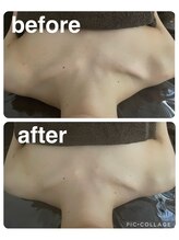 ギンザアール(GINZA R.)/肩こりケア！