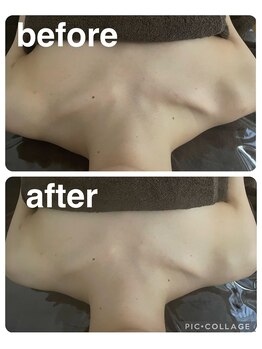 ギンザアール(GINZA R.)/肩こりケア！