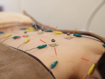 美鍼堂/体質ケア