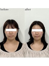 ヴェルシック(Belchic)/土台からの引き締めで圧倒的効果