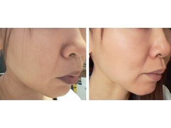 マナ(mana)/2週間で引き締まる☆