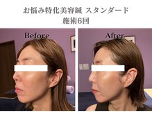 シー バイ カリスタ 表参道店(C by CALISTA)/赤みが引き、肌のツヤ感がUP