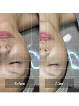 プラスボーテ 幡ヶ谷(plus beaute)/小顔・疲労回復・ヘッドスパ