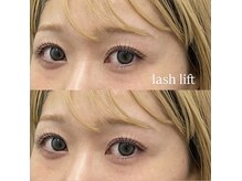 オムズアイ(om's eye.)/丸みつけてぱっちり