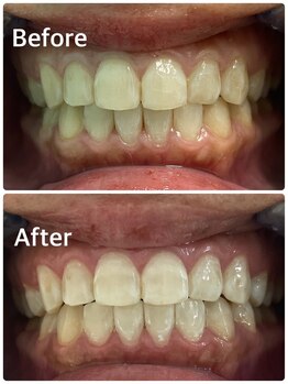 プラチナムビューティー 横須賀店/ビフォーアフター