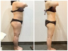 美容整体ウェリナ 中川八田院/小顔矯正/骨盤矯正/痩身整体