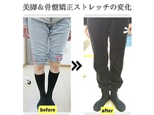 ストレッチヒーロー 岡山問屋町店/スラっとした脚に！