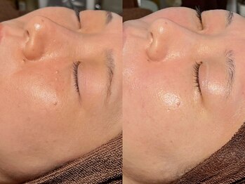 ルーナジェーナ(Luna llena)/