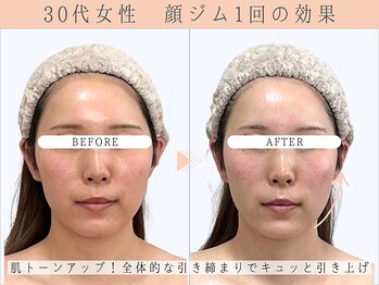 那賀洋子式 顔ジム 大分戸次店/30代女性顔ジム1回の効果