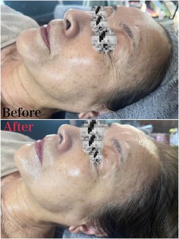 マシェリ(ma-che'rie)/バクチ甦生プログラム