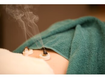 セントラルたなか鍼灸院 上社院の写真/【寝ても取れない疲れに◎】鍼灸・マッサージ・カッピングを駆使し、滞りを巡らせ心身ともにリフレッシュ♪