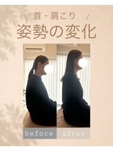アオ 香椎(AO)/before→after