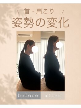 アオ 香椎(AO)/before→after