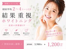 エクシアホワイトニング 岡崎店