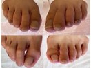 フットネイル自爪ケア&角質ケア1