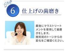 ホワイトニングカフェ イオン新潟青山店(WhiteningCafe)/★歯も心もピッカピカ★