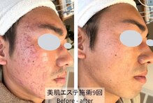 ひかり素肌