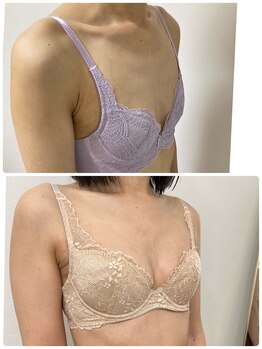 アンド ユー(and.yu)/バストアップ施術７回