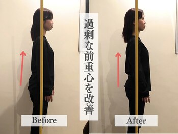 アライメントトウキョウ 表参道(Alignment TOKYO)/前重心改善(姿勢矯正)
